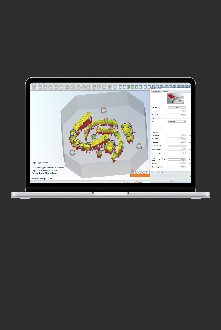CAD/CAM 디자인