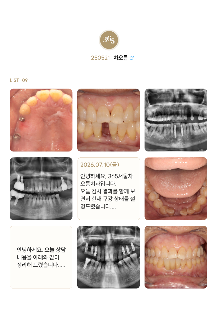 차오름촬영