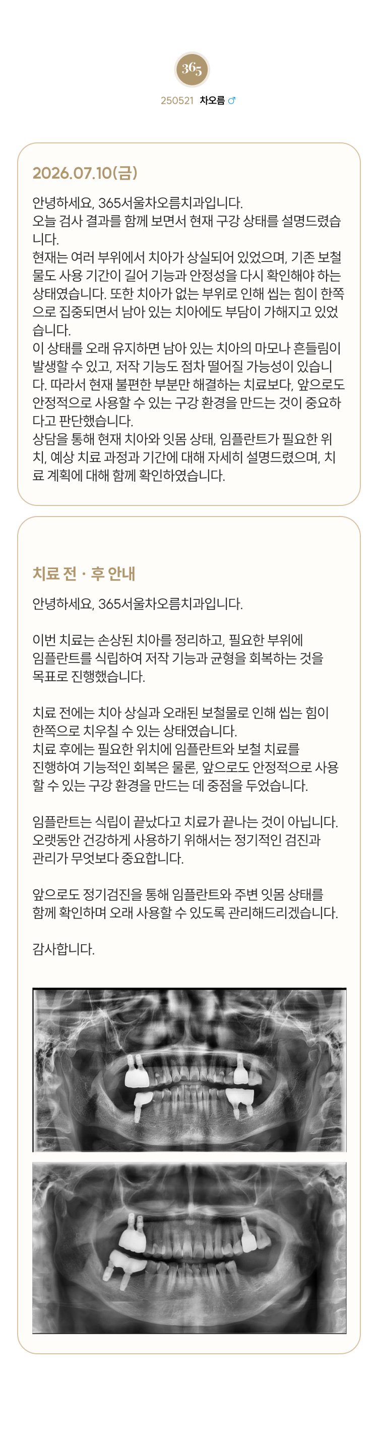 차오름촬영